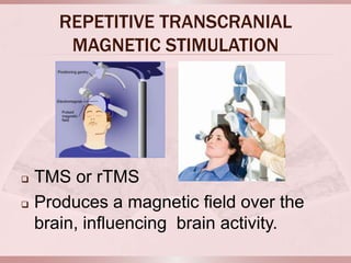 REPETITIVE TRANSCRANIAL
        MAGNETIC STIMULATION




   TMS or rTMS
   Produces a magnetic field over the
    brain, influencing brain activity.
 