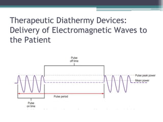 Therapeutic Diathermy Devices:
Delivery of Electromagnetic Waves to
the Patient
 