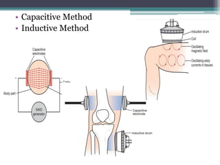 • Capacitive Method
• Inductive Method
 