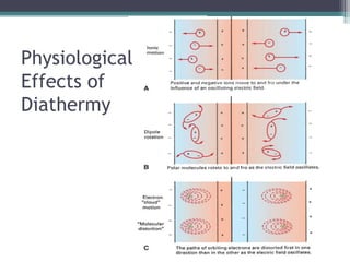 Physiological
Effects of
Diathermy
 