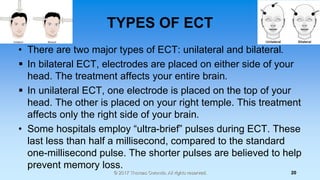 TYPES OF ECT
• There are two major types of ECT: unilateral and bilateral.
 In bilateral ECT, electrodes are placed on ei...