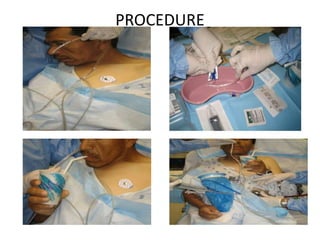 PROCEDURE
 