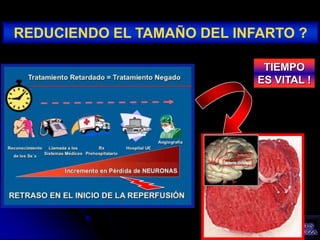 REDUCIENDO EL TAMAÑO DEL INFARTO ?

                             TIEMPO
                            ES VITAL !
 
