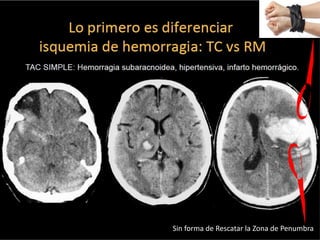 Sin forma de Rescatar la Zona de Penumbra
 