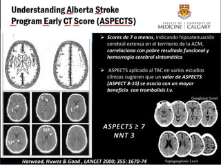 ASPECTS : Alberta Stroke Program Early CT score


Escala en Score ASPECTS 10 Puntos    Scores de 7 o menos, indicando hipoatenuación
                                      cerebral extensa en el territorio de la ACM,
                                      correlaciona con pobre resultado funcional y
                                      hemorragia cerebral sintomática

                                     ASPECTS aplicado al TAC en varios estudios
                                      clínicos sugieren que un valor de ASPECTS
                                      (ASPECT 8-10) se asocia con un mayor
                                      beneficio con trombolisis i.v.




    Harwood, Huwez & Good , LANCET 2000; 355: 1670-74
 