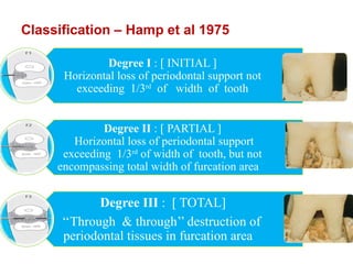 Hamp Classification PPT - TREATMENT IN FURCATION INVOLVEMENT.pptx