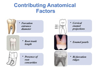 PPT - TREATMENT IN FURCATION INVOLVEMENT.pptx