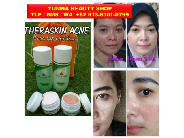 Cream Pemutih Wajah Yang Aman Dan Permanen Berbagi Informasi