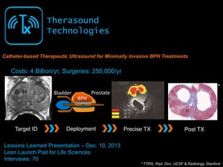 Tx

Therasound
Technologies

Catheter-based Therapeutic Ultrasound for Minimally Invasive BPH Treatments

Costs: 4 Billion/yr; Surgeries: 250,000/yr
*
BPH

Target ID

Bladder

Prostate
BPH

Deployment

Precise TX

Post TX

Lessons Learned Presentation – Dec. 10, 2013
Lean Launch Pad for Life Sciences
Interviews: 70
* TTRG, Rad. Onc, UCSF & Radiology, Stanford

 