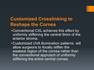 Customized Crosslinking to
Reshape the Cornea
Conventional CXL achieves this effect by
uniformly stiffening the central 9mm of the
anterior stroma.
Customized UVA illumination patterns will
allow surgeons to focally stiffen the
weakest region of the cornea rather than
the conventional approach of uniformly
stiffening the entire central cornea.
 