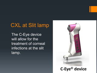 CXL at Slit lamp
The C-Eye device
will allow for the
treatment of corneal
infections at the slit
lamp.
 