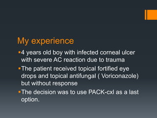 My experience
4 years old boy with infected corneal ulcer
with severe AC reaction due to trauma
The patient received topical fortified eye
drops and topical antifungal ( Voriconazole)
but without response
The decision was to use PACK-cxl as a last
option.
 