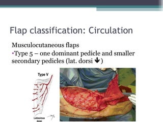 Pedicle Flaps Example The Reconstructive Ladder - Mussa Mensa | PPT