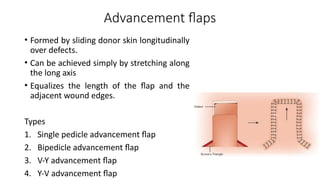 THE RECONSTRUCTIVE LADDER BY DR BINOD CHAUDHARY | PPTX
