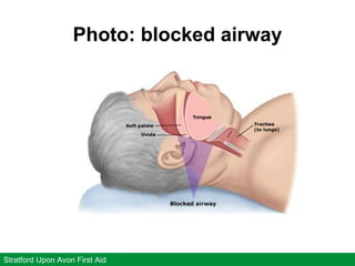 Photo: blocked airway
Stratford Upon Avon First Aid
 