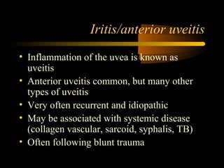 Iritis/anterior uveitis
• Inflammation of the uvea is known as
uveitis
• Anterior uveitis common, but many other
types of uveitis
• Very often recurrent and idiopathic
• May be associated with systemic disease
(collagen vascular, sarcoid, syphalis, TB)
• Often following blunt trauma
 