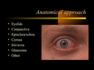 Anatomical approach
• Eyelids
• Conjunctiva
• Episclera/sclera
• Cornea
• Iris/uvea
• Glaucoma
• Other
 