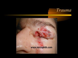 Trauma
 