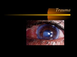 Trauma
 