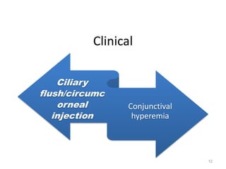 Clinical
Ciliary
flush/circumc
orneal
injection
Conjunctival
hyperemia
12
 