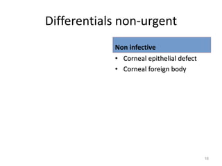 Differentials non-urgent
Non infective
• Corneal epithelial defect
• Corneal foreign body
16
 
