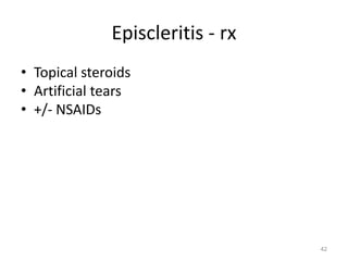 Episcleritis - rx
• Topical steroids
• Artificial tears
• +/- NSAIDs
42
 