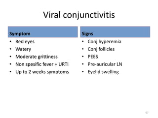 Viral conjunctivitis
Symptom
• Red eyes
• Watery
• Moderate grittiness
• Non spesific fever + URTI
• Up to 2 weeks symptoms
Signs
• Conj hyperemia
• Conj follicles
• PEES
• Pre-auricular LN
• Eyelid swelling
67
 