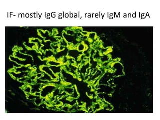 IF- mostly IgG global, rarely IgM and IgA
 