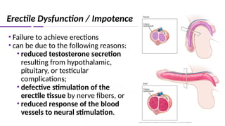 Erectile Dysfunction / Impotence
• Failure to achieve erections
• can be due to the following reasons:
• reduced testosterone secretion
resulting from hypothalamic,
pituitary, or testicular
complications;
• defective stimulation of the
erectile tissue by nerve fibers, or
• reduced response of the blood
vessels to neural stimulation.
 