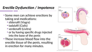 Erectile Dysfunction / Impotence
• Some men can achieve erections by
taking oral medications:
• sildenafil (Viagra)
• tadalafil (Cialis)
• verdenafil (Livitra)
• or by having specific drugs injected
into the base of the penis
• These increase blood flow into the
erectile tissue of the penis, resulting
in erection for many minutes.
 