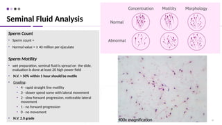 42
Sperm Count
• Sperm count =
• Normal value = ≥ 40 million per ejaculate
Sperm Motility
• wet preparation, seminal fluid is spread on the slide,
evaluation is done at least 20 high power field
• N.V. > 50% within 1 hour should be motile
• Grading:
• 4 - rapid straight line motility
• 3 - slower speed some with lateral movement
• 2 - slow forward progression, noticeable lateral
movement
• 1 - no forward progression
• 0 - no movement
• N.V. 2.0 grade
Seminal Fluid Analysis
 