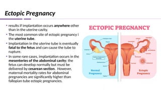 Ectopic Pregnancy
• results if implantation occurs anywhere other
than in the uterine cavity.
• The most common site of ectopic pregnancy is
the uterine tube.
• Implantation in the uterine tube is eventually
fatal to the fetus and can cause the tube to
rupture.
• In some rare cases, implantation occurs in the
mesenteries of the abdominal cavity; the
fetus can develop normally but must be
delivered by cesarean section. However,
maternal mortality rates for abdominal
pregnancies are significantly higher than
fallopian tube ectopic pregnancies.
 