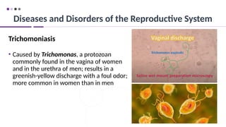 93
Trichomoniasis
• Caused by Trichomonas, a protozoan
commonly found in the vagina of women
and in the urethra of men; results in a
greenish-yellow discharge with a foul odor;
more common in women than in men
Diseases and Disorders of the Reproductive System
 