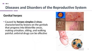 95
Genital herpes
• Caused by herpes simplex 2 virus;
characterized by lesions on the genitals
that progress into blisterlike areas,
making urination, sitting, and walking
painful; antiviral drugs can be effective
Diseases and Disorders of the Reproductive System
 
