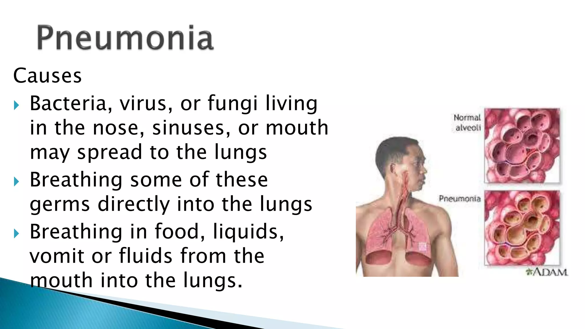 Causes
Bacteria, virus, or fungi living
in the nose, sinuses, or mouth
may spread to the lungs
Breathing some of these
germs directly into the lungs
Breathing in food, liquids,
vomit or fluids from the
mouth into the lungs.