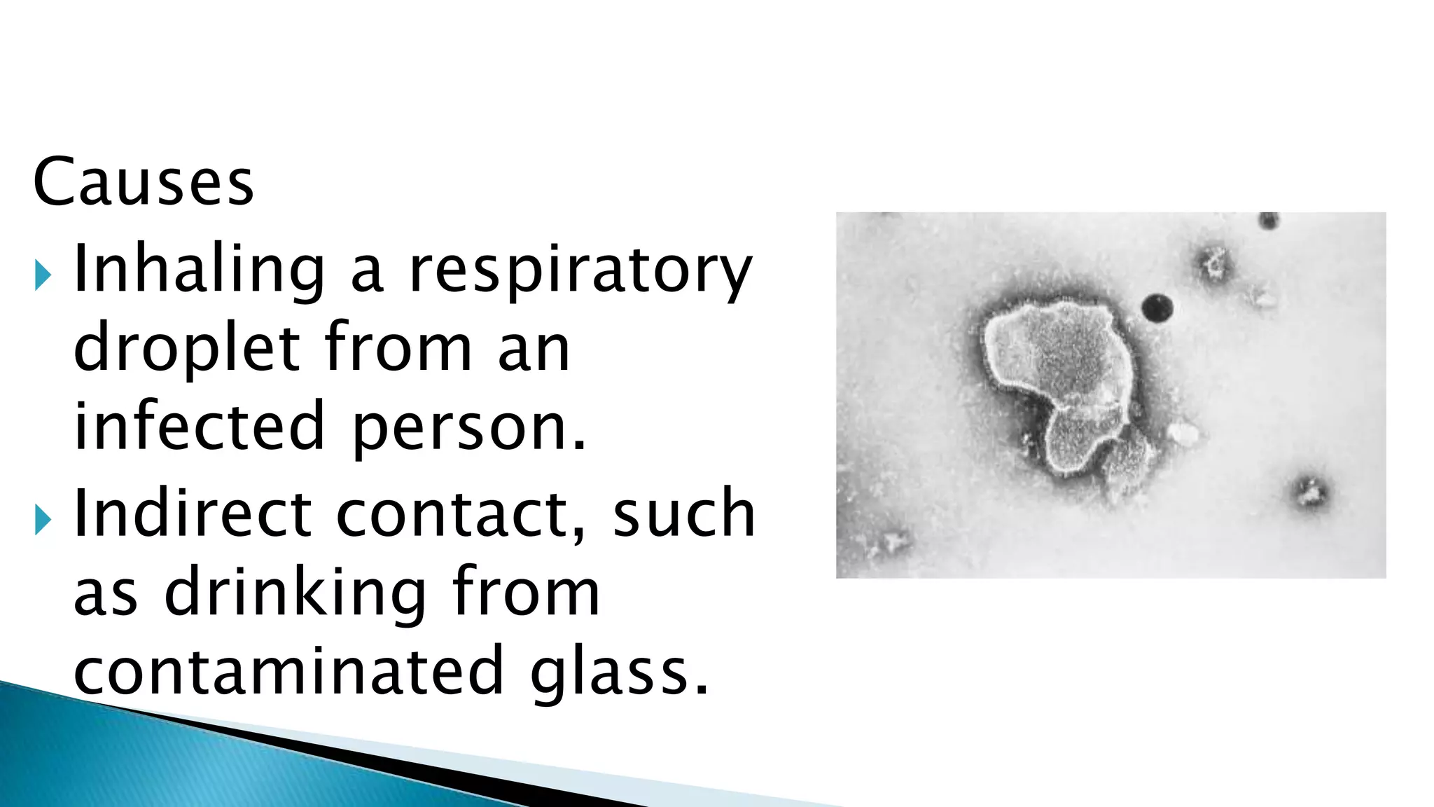 Causes
Inhaling a respiratory
droplet from an
infected person.
Indirect contact, such
as drinking from
contaminated glass.