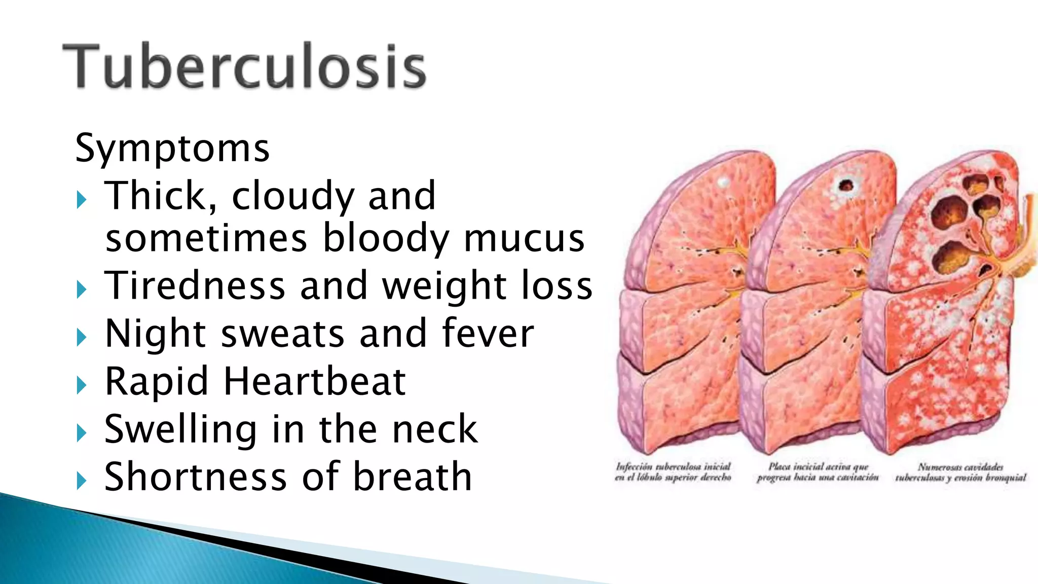 Symptoms
Thick, cloudy and
sometimes bloody mucus
Tiredness and weight loss
Night sweats and fever
Rapid Heartbeat
Swelling in the neck
Shortness of breath