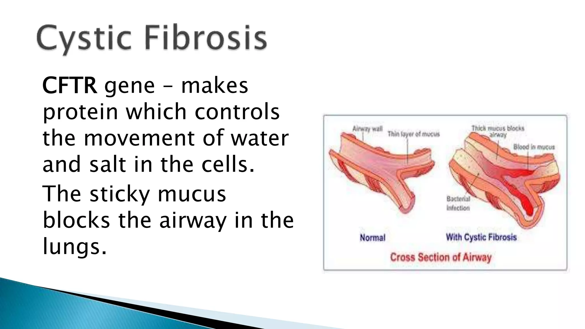 CFTR gene – makes
protein which controls
the movement of water
and salt in the cells.
The sticky mucus
blocks the airway in the
lungs.