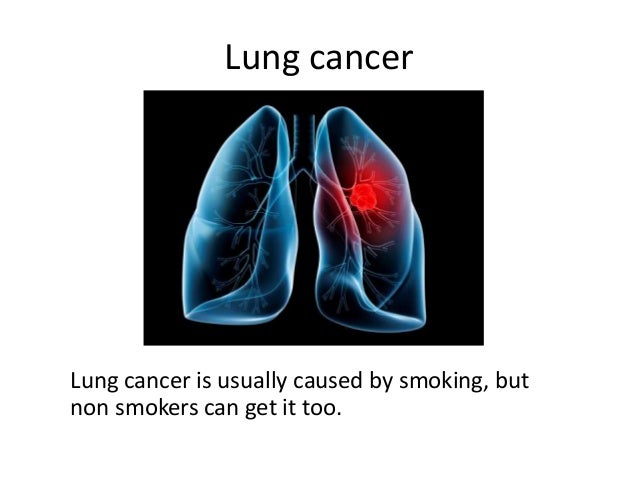 The respiratory system