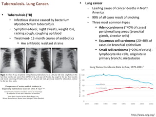 Tuberculosis. Lung Cancer.
• Tuberculosis (TB)
– Infectious disease caused by bacterium
Mycobacterium tuberculosis
– Symptoms-fever, night sweats, weight loss,
racking cough, coughing up blood
– Treatment- 12-month course of antibiotics
• Are antibiotic resistant strains
• Lung cancer
– Leading cause of cancer deaths in North
America
– 90% of all cases result of smoking
– Three most common types
• Adenocarcinoma (~40% of cases)
peripheral lung areas (bronchial
glands, alveolar cells)
• Squamous cell carcinoma (20–40% of
cases) in bronchial epithelium
• Small cell carcinoma (~20% of cases) -
lymphocyte-like cells; originate in
primary bronchi; metastasize
http://www.lung.org/
 