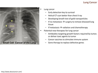 Lung Cancer
• Lung cancer
– Early detection key to survival
– Helical CT scan better than chest X ray
– Developing breath test of gold nanoparticles
– If no metastasis  surgery to remove diseased lung
tissue
– If metastasis  radiation and chemotherapy
• Potential new therapies for lung cancer
– Antibodies targeting growth factors required by tumor;
or deliver toxic agents to tumor
– Cancer vaccines to stimulate immune system
– Gene therapy to replace defective genes
http://www.aboutcancer.com/
 