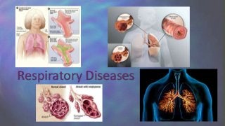 Respiratory Diseases
 