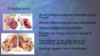  Alveoli enlarge as adjacent chambers break
through
 Chronic inflammation promotes lung fibrosis
 Airways collapse during expiration
 Patients use a large amount of energy to
exhale
 Over inflation of the lungs leads to a
permanently expanded barrel chest
 Cyanosis appears late in the disease
Emphysema
 