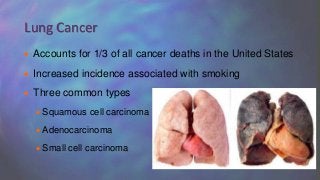  Accounts for 1/3 of all cancer deaths in the United States
 Increased incidence associated with smoking
 Three common types
 Squamous cell carcinoma
 Adenocarcinoma
 Small cell carcinoma
Lung Cancer
 