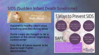  Apparently healthy infant stops
breathing and dies during sleep
 Some cases are thought to be a
problem of the neural respiratory
control center
 One third of cases appear to be
due to heart rhythm
abnormalities
SIDS (Sudden Infant Death Syndrome)
 
