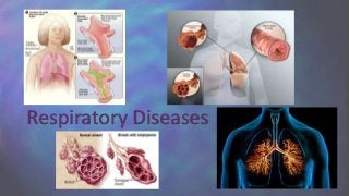  Features of these diseases
Patients almost always have a history of smoking
Labored breathing (dyspnea) becomes progre...