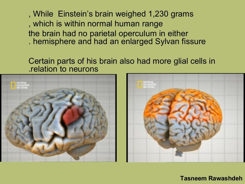 The Rriddle Of Einstein's Brain