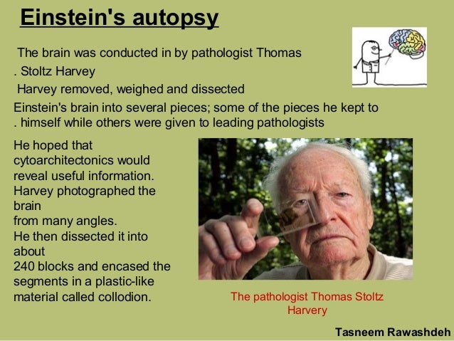 Albert Einstein brain holland township school webpage