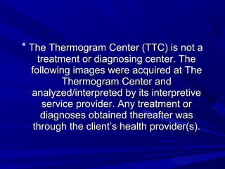* The Thermogram Center (TTC) is not a
   treatment or diagnosing center. The
 following images were acquired at The
         Thermogram Center and
 analyzed/interpreted by its interpretive
    service provider. Any treatment or
    diagnoses obtained thereafter was
  through the client’s health provider(s).
 