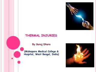 THERMAL INJURIES
By Suraj Dhara
(Midnapore Medical College &
Hospital, West Bengal, India)
 